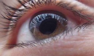 External close-up of a human eye showing the lashes and lid margin